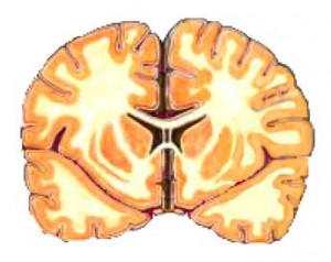 human-brain-cross-section-345-274-14